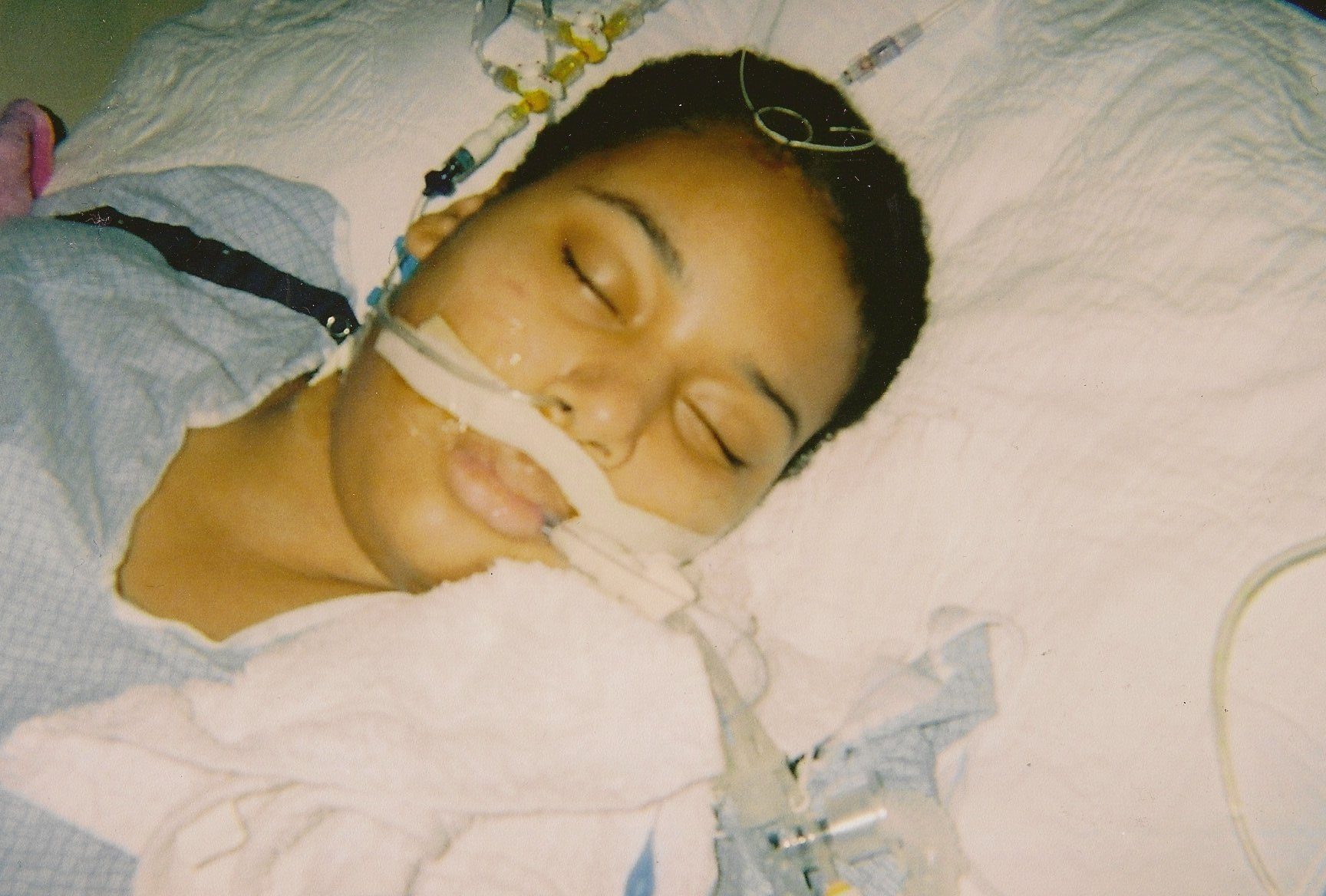 Chaunell intubated