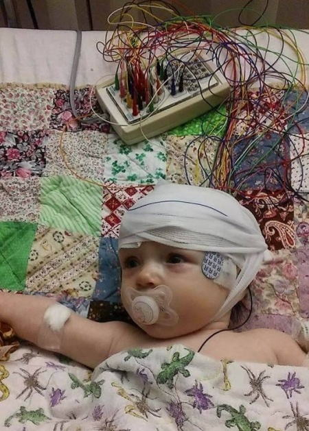Kelsey baby after surgery