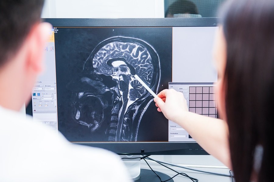 Doctors consider and discuss magnetic resonance image (MRI) of the brain.