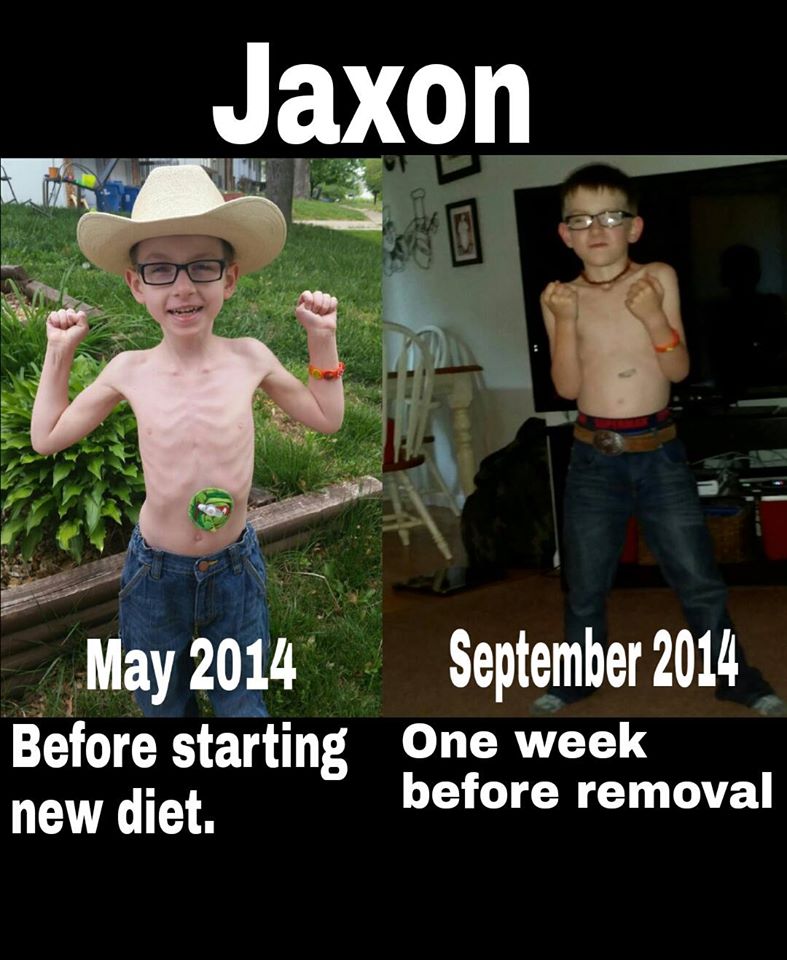 Jaxon Weight