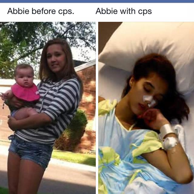 Abbie before and after CPS